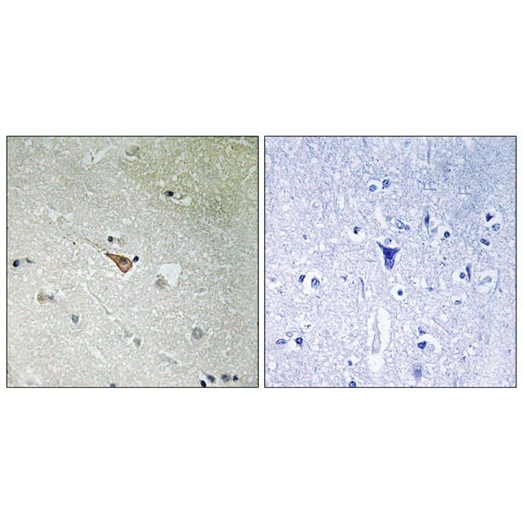 Immunohistochemistry - Anti-ALK (phospho Tyr1096) Antibody (A8077) - Antibodies.com