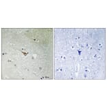 Immunohistochemistry - Anti-ALK (phospho Tyr1096) Antibody (A8077) - Antibodies.com