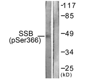 Western Blot - Anti-SSB (phospho Ser366) Antibody (A1181) - Antibodies.com