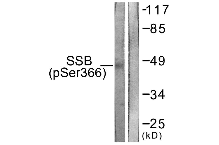 Western Blot - Anti-SSB (phospho Ser366) Antibody (A1181) - Antibodies.com