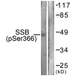 Western Blot - Anti-SSB (phospho Ser366) Antibody (A1181) - Antibodies.com