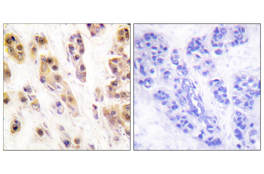 Immunohistochemistry - Anti-SSB (phospho Ser366) Antibody (A1181) - Antibodies.com