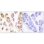 Immunohistochemistry - Anti-SSB (phospho Ser366) Antibody (A1181) - Antibodies.com