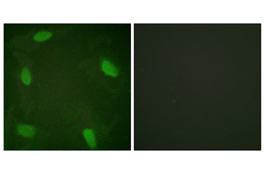 Immunofluorescence - Anti-SSB (phospho Ser366) Antibody (A1181) - Antibodies.com