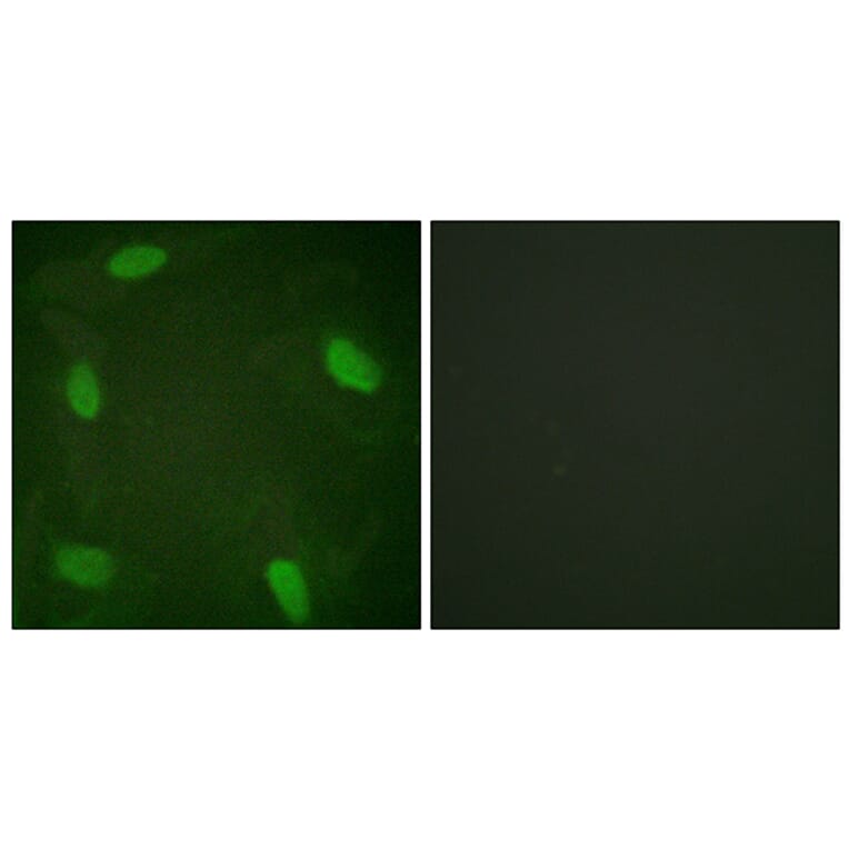 Immunofluorescence - Anti-SSB (phospho Ser366) Antibody (A1181) - Antibodies.com