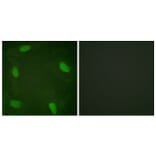 Immunofluorescence - Anti-SSB (phospho Ser366) Antibody (A1181) - Antibodies.com