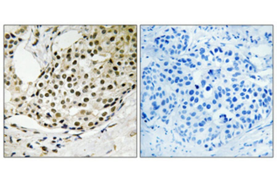 Immunohistochemistry - Anti-SSB (phospho Ser366) Antibody (A1181) - Antibodies.com