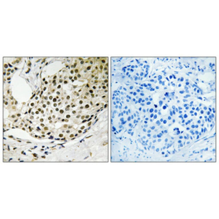 Immunohistochemistry - Anti-SSB (phospho Ser366) Antibody (A1181) - Antibodies.com