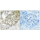 Immunohistochemistry - Anti-SSB (phospho Ser366) Antibody (A1181) - Antibodies.com