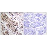 Immunohistochemistry - Anti-p53 (phospho Ser392) Antibody (A0530) - Antibodies.com