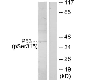 Western Blot - Anti-p53 (phospho Ser315) Antibody (A7181) - Antibodies.com