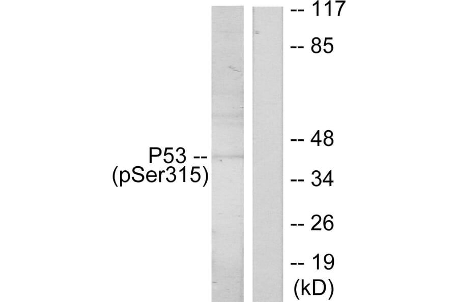 Western Blot - Anti-p53 (phospho Ser315) Antibody (A7181) - Antibodies.com
