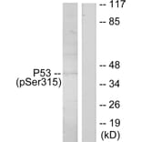 Western Blot - Anti-p53 (phospho Ser315) Antibody (A7181) - Antibodies.com