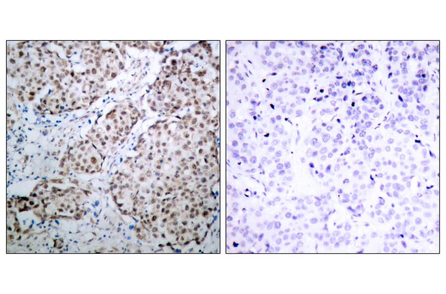 Immunohistochemistry - Anti-p53 (phospho Ser315) Antibody (A7181) - Antibodies.com
