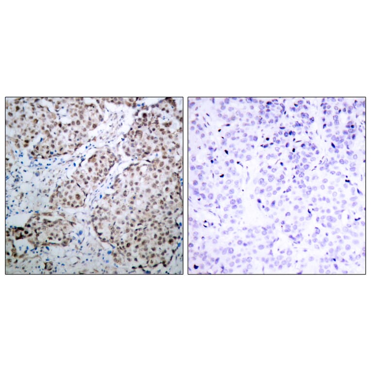 Immunohistochemistry - Anti-p53 (phospho Ser315) Antibody (A7181) - Antibodies.com