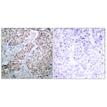Immunohistochemistry - Anti-p53 (phospho Ser315) Antibody (A7181) - Antibodies.com