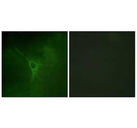 Immunofluorescence - Anti-GFAP (phospho Ser38) Antibody (A1205) - Antibodies.com
