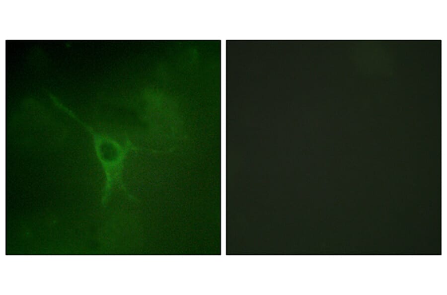 Immunofluorescence - Anti-GFAP (phospho Ser38) Antibody (A1205) - Antibodies.com
