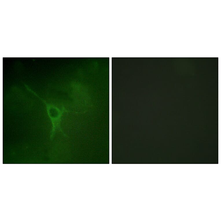 Immunofluorescence - Anti-GFAP (phospho Ser38) Antibody (A1205) - Antibodies.com