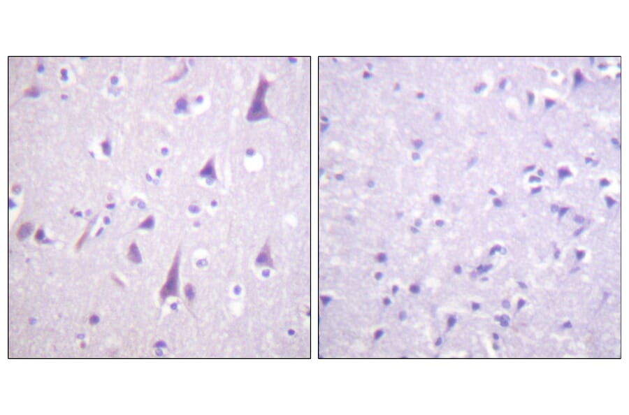 Immunohistochemistry - Anti-GFAP (phospho Ser38) Antibody (A1205) - Antibodies.com