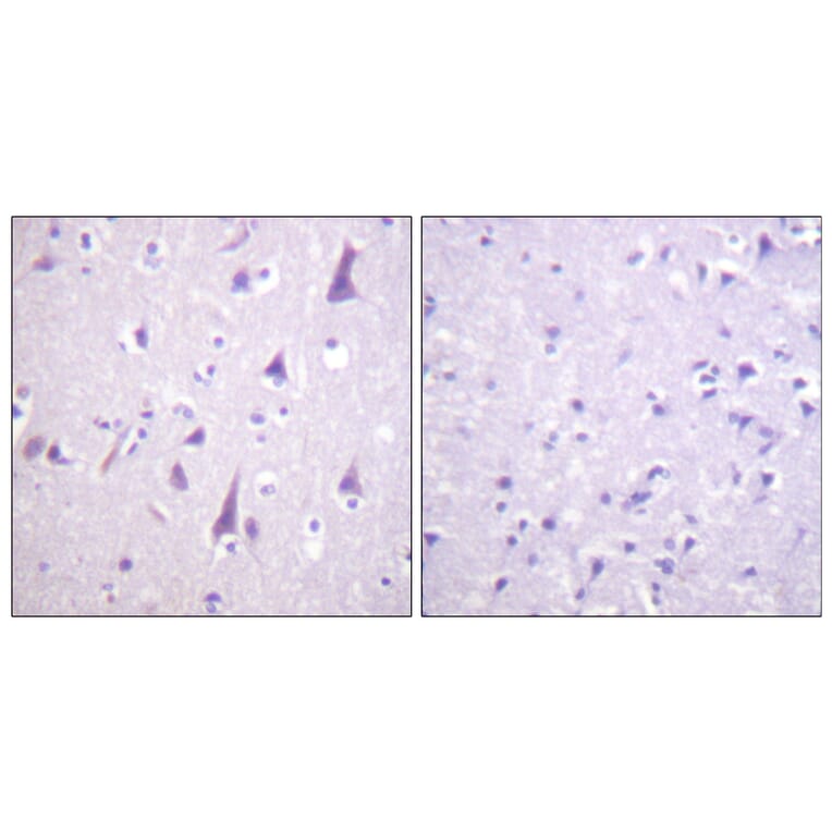 Immunohistochemistry - Anti-GFAP (phospho Ser38) Antibody (A1205) - Antibodies.com