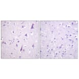 Immunohistochemistry - Anti-GFAP (phospho Ser38) Antibody (A1205) - Antibodies.com