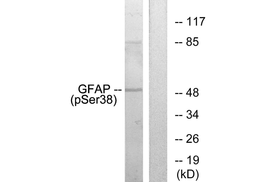 Western Blot - Anti-GFAP (phospho Ser38) Antibody (A1205) - Antibodies.com