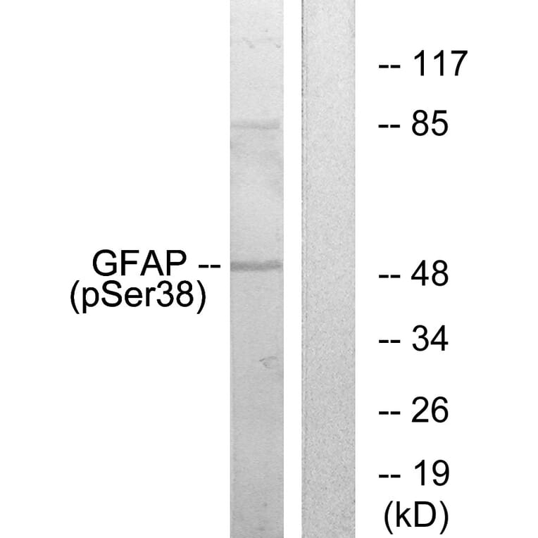 Western Blot - Anti-GFAP (phospho Ser38) Antibody (A1205) - Antibodies.com