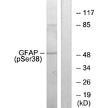 Western Blot - Anti-GFAP (phospho Ser38) Antibody (A1205) - Antibodies.com