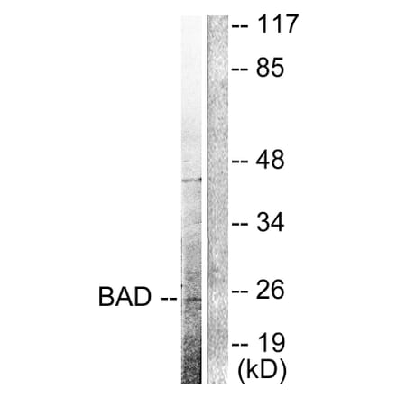 Western Blot - Anti-BAD (cleaved Asp71) Antibody (L0102) - Antibodies.com