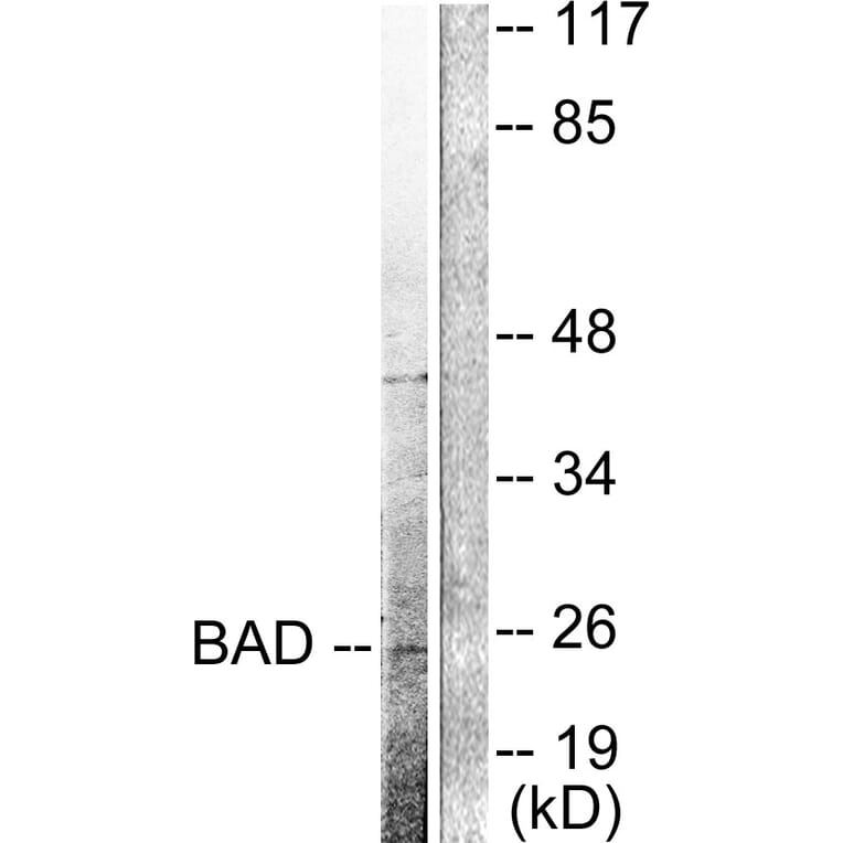 Western Blot - Anti-BAD (cleaved Asp71) Antibody (L0102) - Antibodies.com