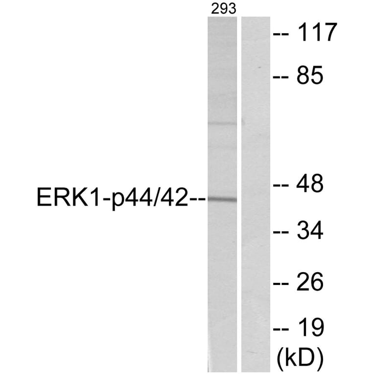Western Blot - Anti-p44/42 MAP Kinase Antibody (B7073) - Antibodies.com