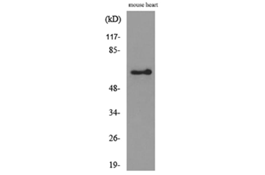 Western Blot - Anti-ANGPTL1 + ANGPTL2 Antibody (C30112) - Antibodies.com