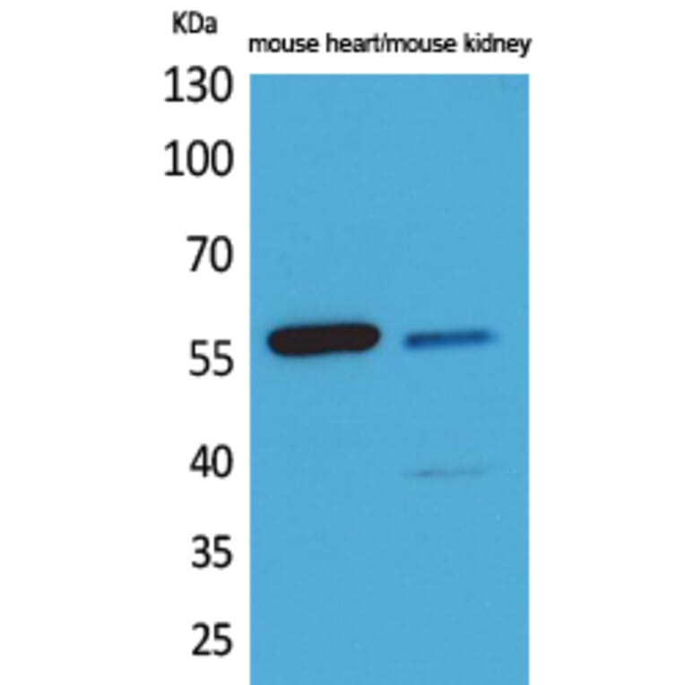 Western Blot - Anti-ANGPTL1 + ANGPTL2 Antibody (C30112) - Antibodies.com