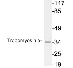 Western Blot - Anti-Tropomyosin alpha Antibody (R12-2391) - Antibodies.com