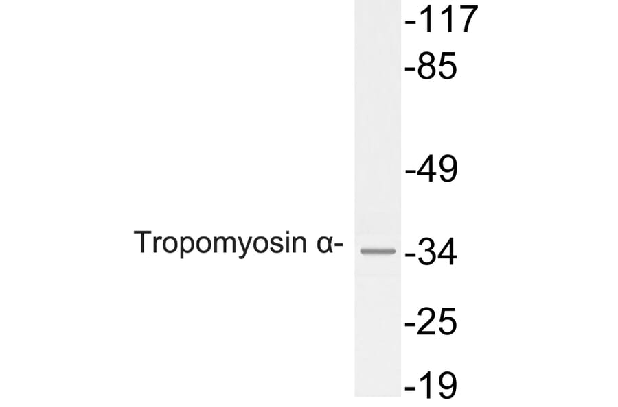 Western Blot - Anti-Tropomyosin alpha Antibody (R12-2391) - Antibodies.com