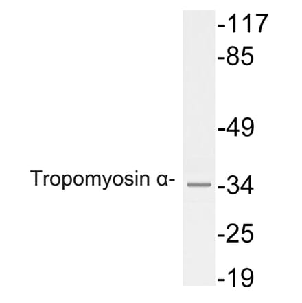 Western Blot - Anti-Tropomyosin alpha Antibody (R12-2391) - Antibodies.com
