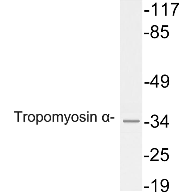 Western Blot - Anti-Tropomyosin alpha Antibody (R12-2391) - Antibodies.com