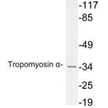 Western Blot - Anti-Tropomyosin alpha Antibody (R12-2391) - Antibodies.com