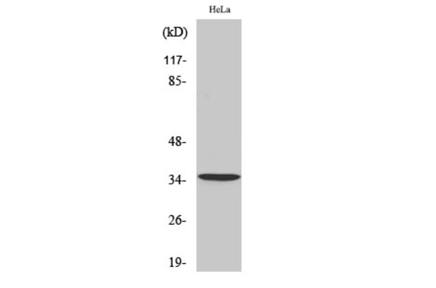 Western Blot - Anti-Tropomyosin alpha Antibody (R12-2391) - Antibodies.com