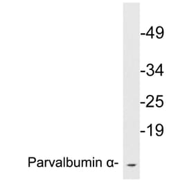 Western Blot - Anti-Parvalbumin alpha Antibody (R12-2291) - Antibodies.com