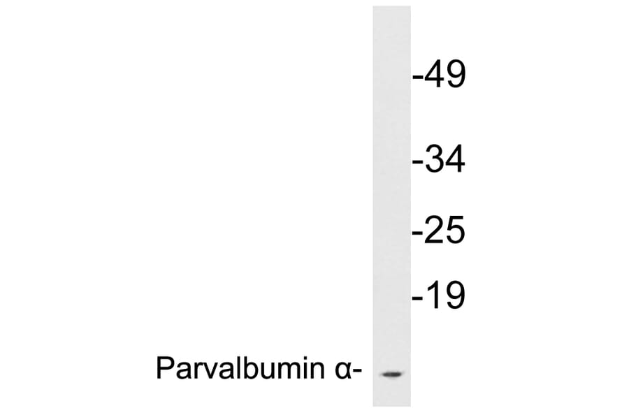 Western Blot - Anti-Parvalbumin alpha Antibody (R12-2291) - Antibodies.com