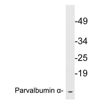 Western Blot - Anti-Parvalbumin alpha Antibody (R12-2291) - Antibodies.com