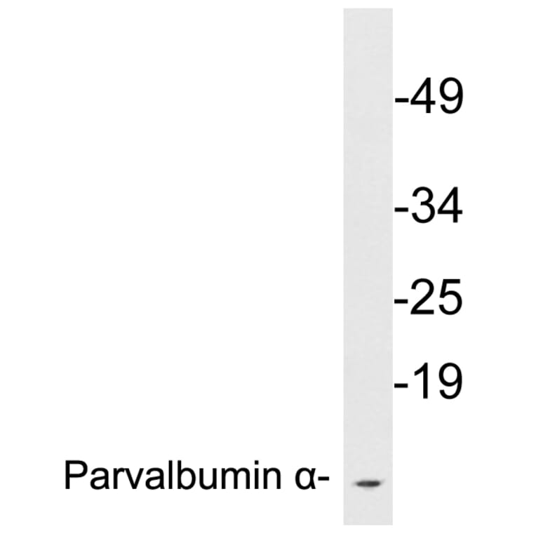 Western Blot - Anti-Parvalbumin alpha Antibody (R12-2291) - Antibodies.com