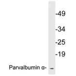 Western Blot - Anti-Parvalbumin alpha Antibody (R12-2291) - Antibodies.com