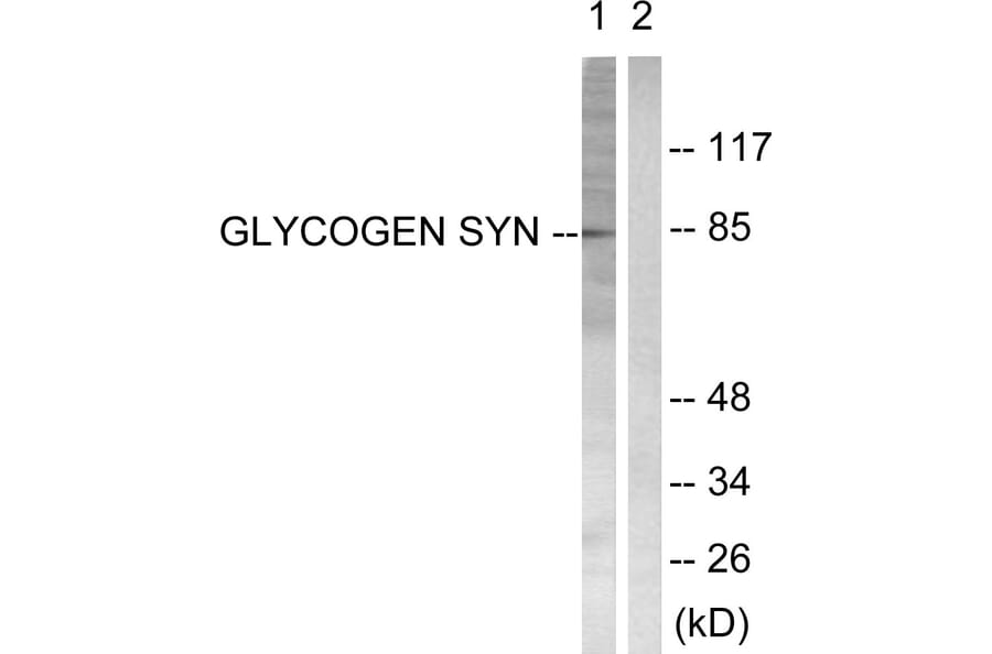 Western Blot - Anti-Glycogen Synthase Antibody (B0431) - Antibodies.com