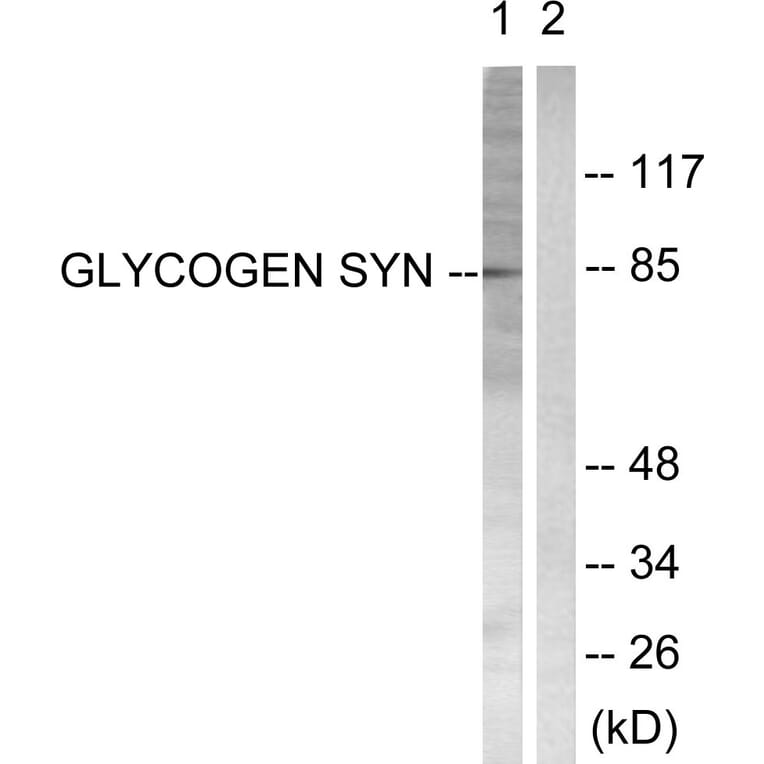 Western Blot - Anti-Glycogen Synthase Antibody (B0431) - Antibodies.com