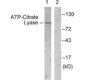 Western Blot - Anti-ATP-Citrate Lyase Antibody (B0618) - Antibodies.com
