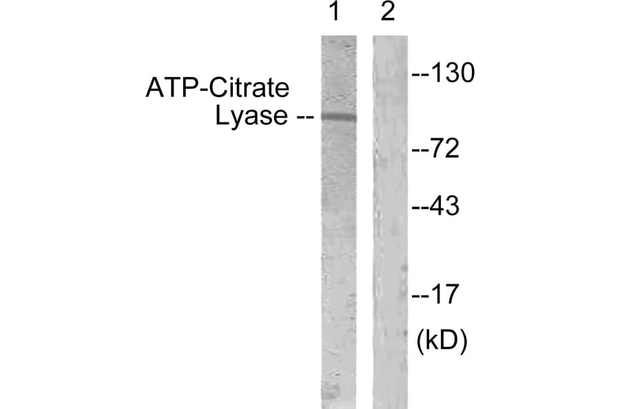 Western Blot - Anti-ATP-Citrate Lyase Antibody (B0618) - Antibodies.com