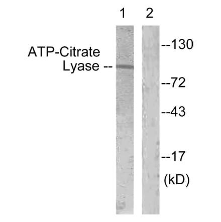 Western Blot - Anti-ATP-Citrate Lyase Antibody (B0618) - Antibodies.com